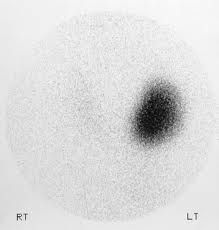 autonomously fn nodule.jpg